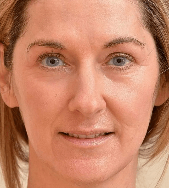 I look younger after using Eudalie cream