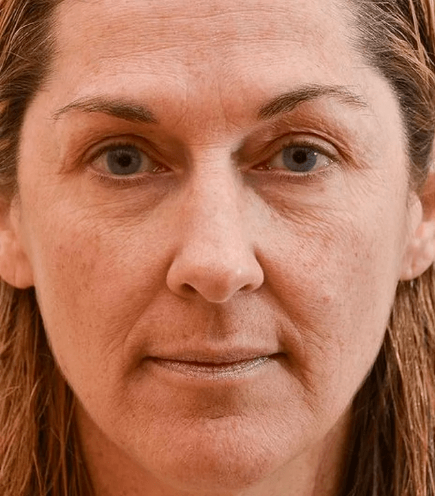 My face before using Eudalie cream