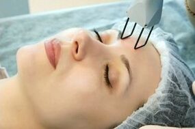 Laser skin rejuvenation