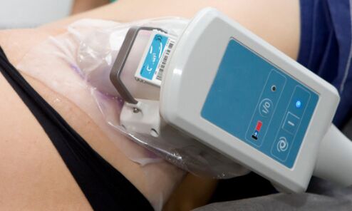 cryolipolysis method for body skin